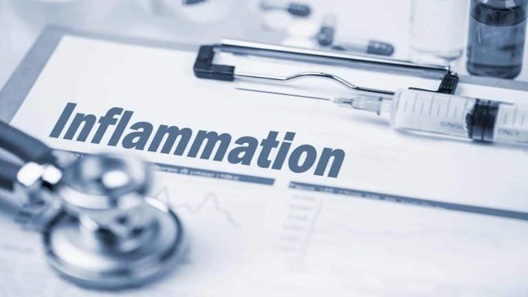 CBD inflammation